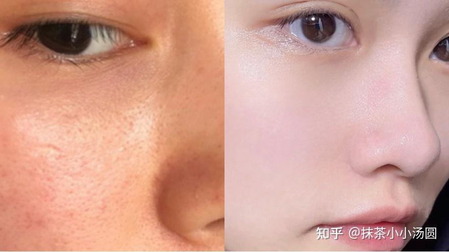 皮肤黄粗糙暗沉什么原因